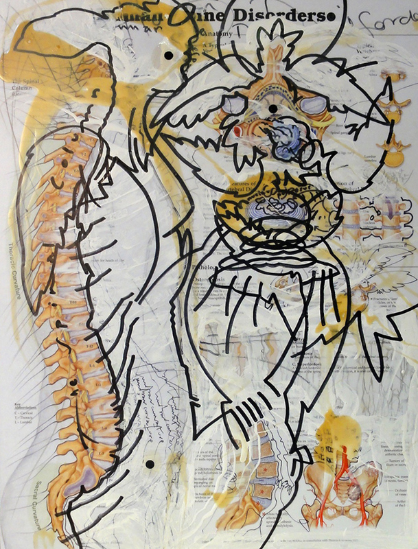 Spinedisorders, 2015